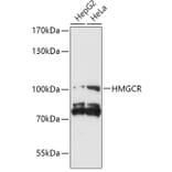 Western Blot - Anti-HMGCR Antibody (A92787) - Antibodies.com