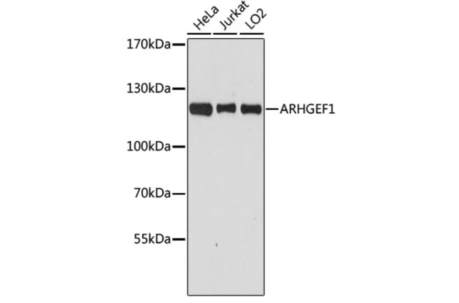 Western Blot - Anti-p115-RhoGEF Antibody (A92788) - Antibodies.com