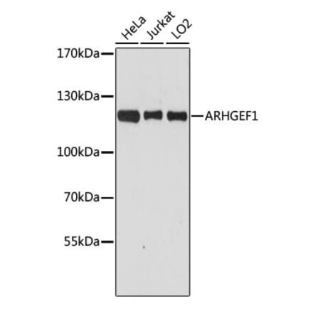 Western Blot - Anti-p115-RhoGEF Antibody (A92788) - Antibodies.com