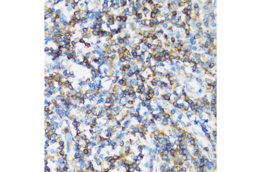 Immunohistochemistry - Anti-p115-RhoGEF Antibody (A92788) - Antibodies.com
