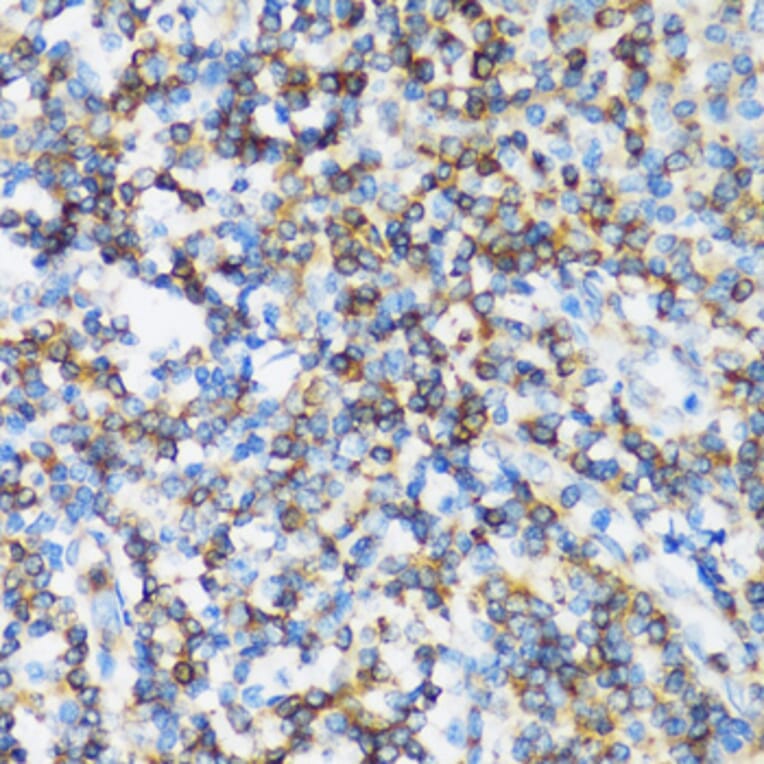Immunohistochemistry - Anti-p115-RhoGEF Antibody (A92788) - Antibodies.com