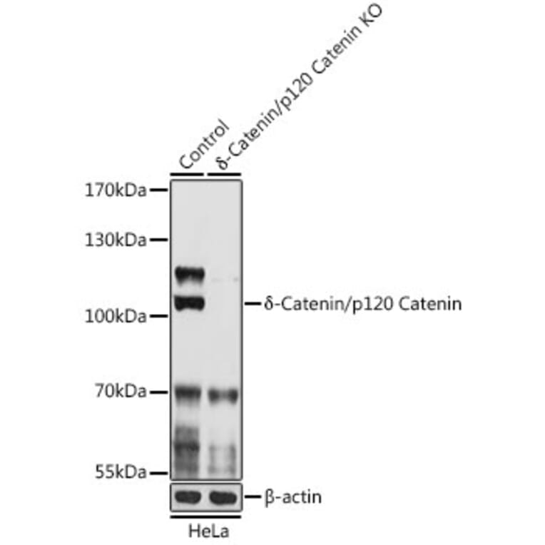 Western Blot - Anti-delta 1 Catenin/CAS Antibody (A92789) - Antibodies.com