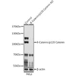 Western Blot - Anti-delta 1 Catenin/CAS Antibody (A92789) - Antibodies.com