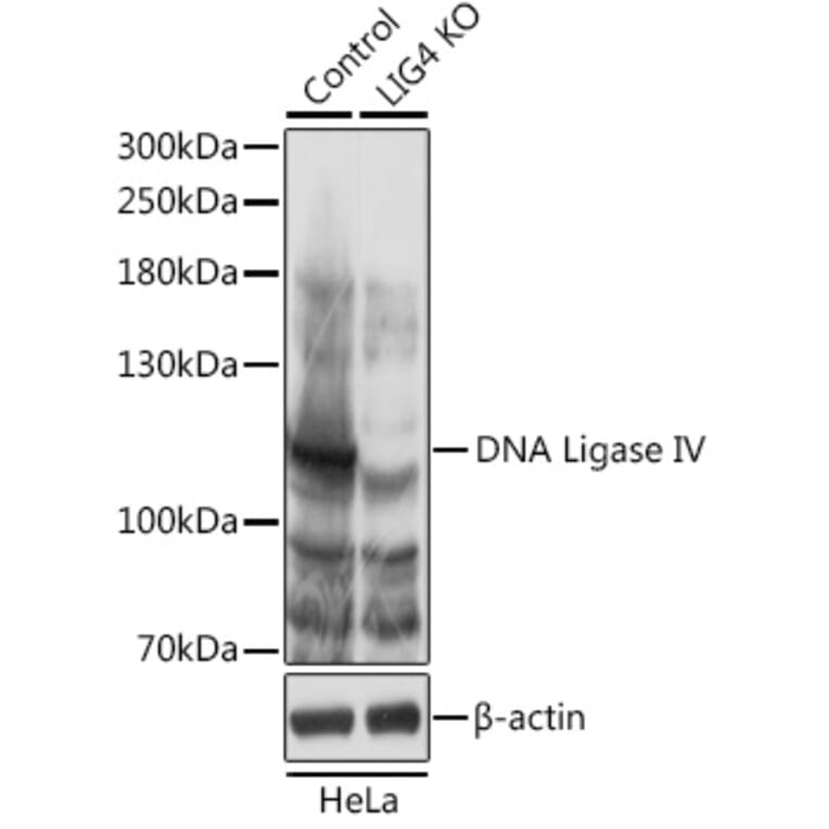 Western Blot - Anti-DNA Ligase IV / LIG4 Antibody (A92790) - Antibodies.com