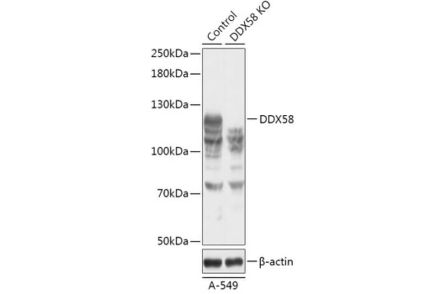 Western Blot - Anti-RIG-I / DDX58 Antibody (A92792) - Antibodies.com