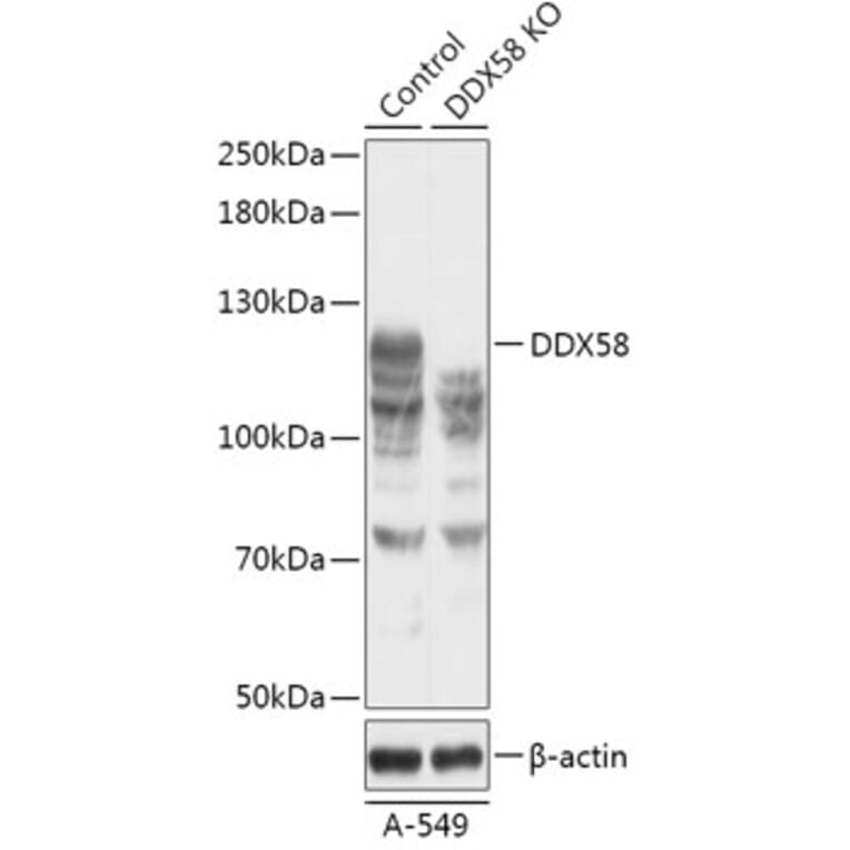 Western Blot - Anti-RIG-I / DDX58 Antibody (A92792) - Antibodies.com