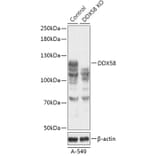 Western Blot - Anti-RIG-I / DDX58 Antibody (A92792) - Antibodies.com