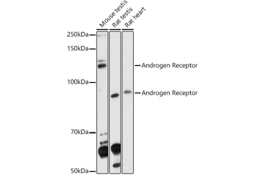 Western Blot - Anti-Androgen Receptor Antibody (A92793) - Antibodies.com