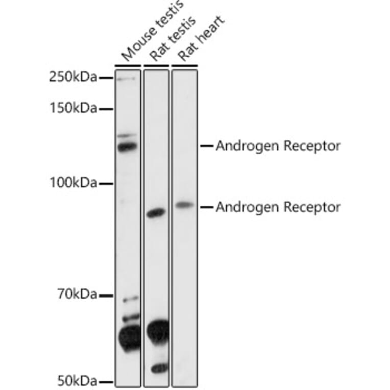 Western Blot - Anti-Androgen Receptor Antibody (A92793) - Antibodies.com