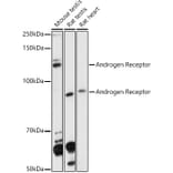 Western Blot - Anti-Androgen Receptor Antibody (A92793) - Antibodies.com