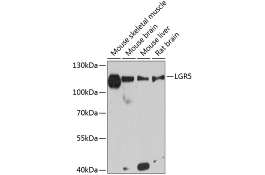 Western Blot - Anti-LGR5 Antibody (A12987) - Antibodies.com