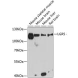 Western Blot - Anti-LGR5 Antibody (A12987) - Antibodies.com