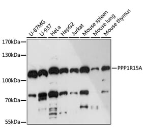 Western Blot - Anti-GADD34 Antibody (A92795) - Antibodies.com