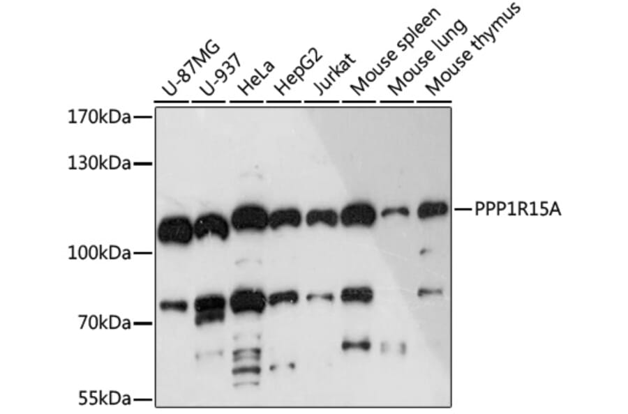 Western Blot - Anti-GADD34 Antibody (A92795) - Antibodies.com