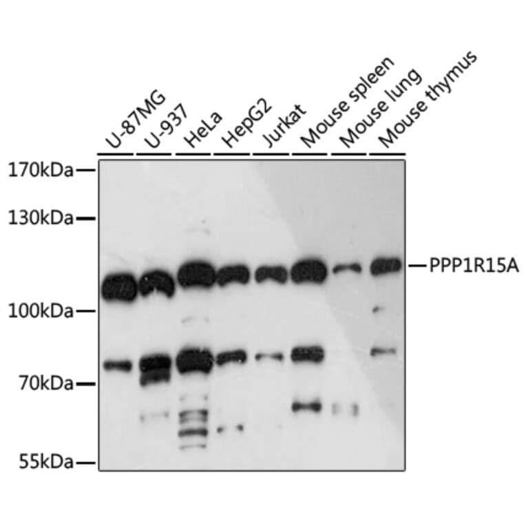 Western Blot - Anti-GADD34 Antibody (A92795) - Antibodies.com