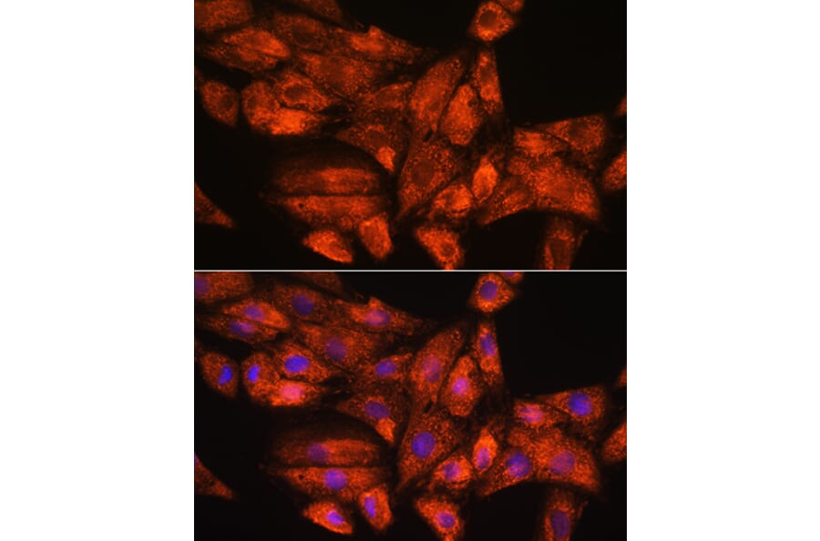 Immunofluorescence - Anti-GADD34 Antibody (A92795) - Antibodies.com