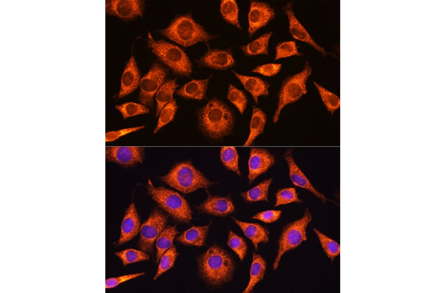 Immunofluorescence - Anti-GADD34 Antibody (A92795) - Antibodies.com