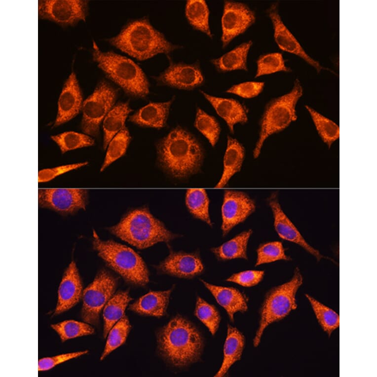 Immunofluorescence - Anti-GADD34 Antibody (A92795) - Antibodies.com