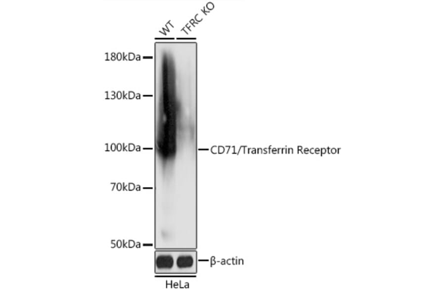 Western Blot - Anti-Transferrin Receptor Antibody (A92796) - Antibodies.com