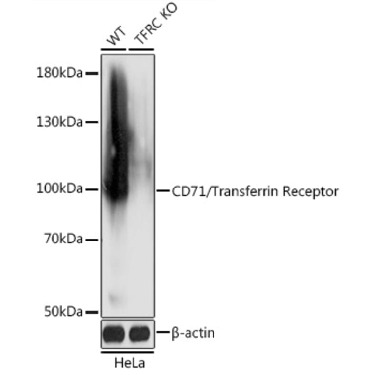 Western Blot - Anti-Transferrin Receptor Antibody (A92796) - Antibodies.com