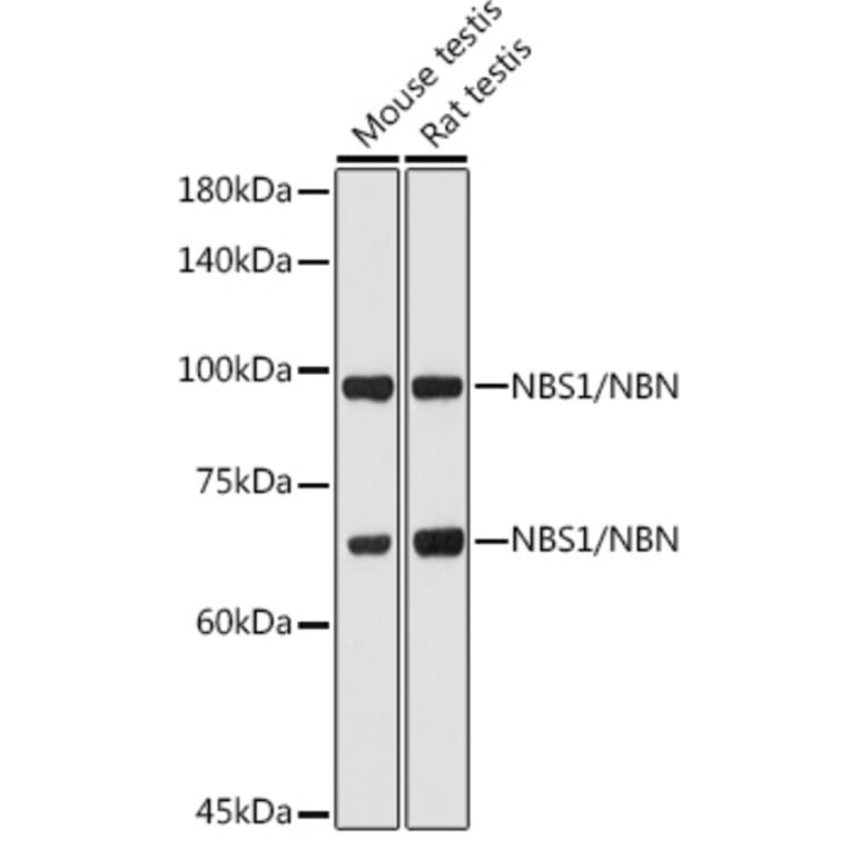 Western Blot - Anti-p95/NBS1 Antibody (A92797) - Antibodies.com