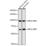 Western Blot - Anti-p95/NBS1 Antibody (A92797) - Antibodies.com