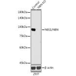 Western Blot - Anti-p95/NBS1 Antibody (A92797) - Antibodies.com
