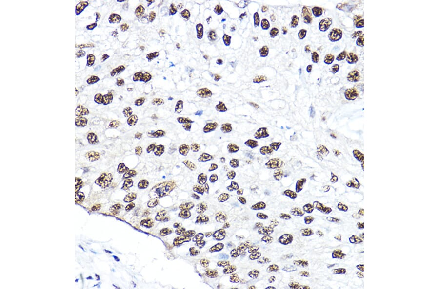 Immunohistochemistry - Anti-p95/NBS1 Antibody (A92797) - Antibodies.com