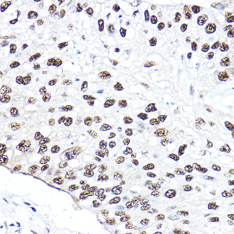 Immunohistochemistry - Anti-p95/NBS1 Antibody (A92797) - Antibodies.com