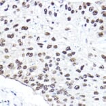 Immunohistochemistry - Anti-p95/NBS1 Antibody (A92797) - Antibodies.com