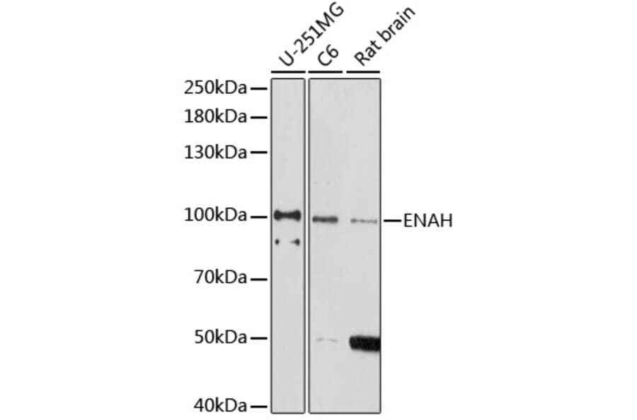Western Blot - Anti-ENAH/MENA Antibody (A92800) - Antibodies.com