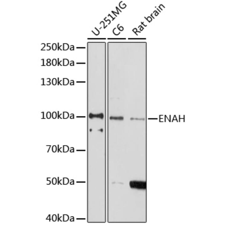 Western Blot - Anti-ENAH/MENA Antibody (A92800) - Antibodies.com
