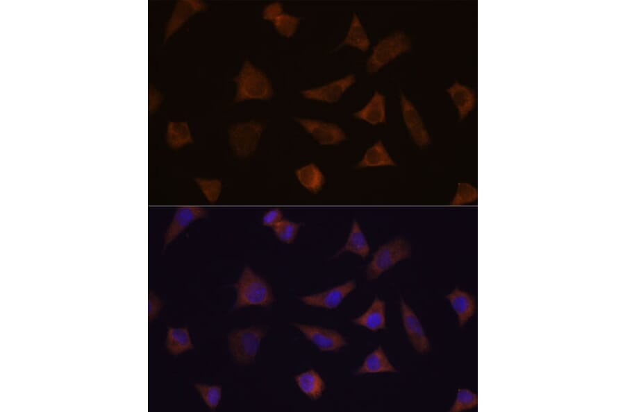 Immunofluorescence - Anti-ENAH/MENA Antibody (A92800) - Antibodies.com
