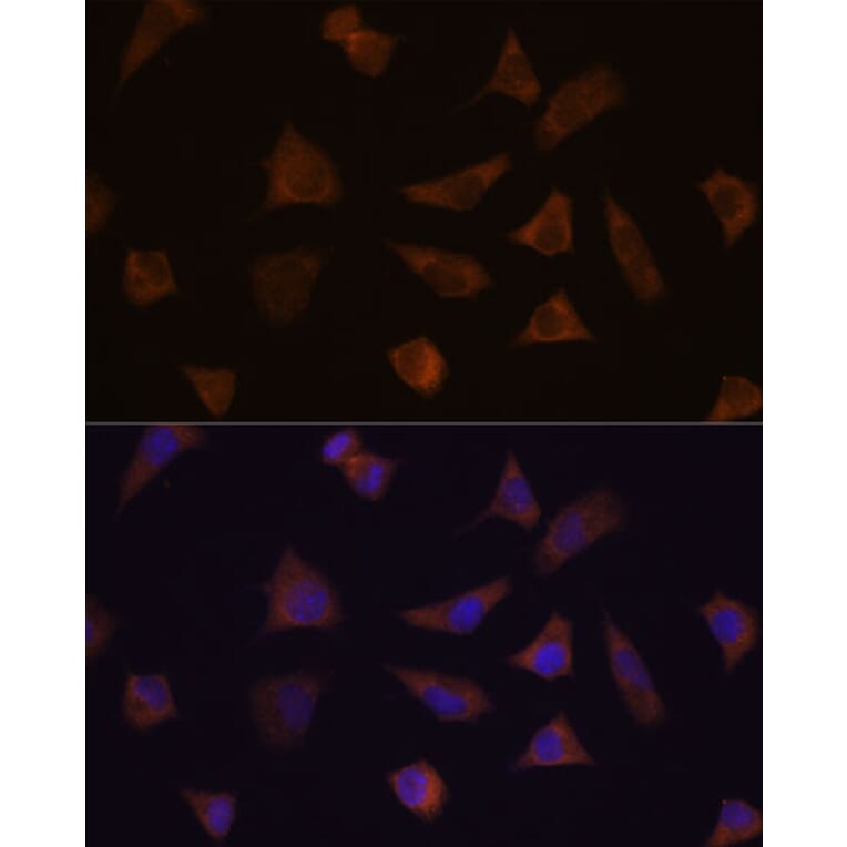 Immunofluorescence - Anti-ENAH/MENA Antibody (A92800) - Antibodies.com