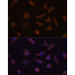 Immunofluorescence - Anti-ENAH/MENA Antibody (A92800) - Antibodies.com