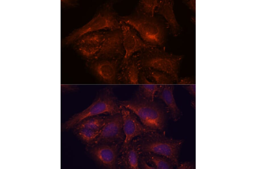 Immunofluorescence - Anti-ENAH/MENA Antibody (A92800) - Antibodies.com