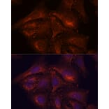 Immunofluorescence - Anti-ENAH/MENA Antibody (A92800) - Antibodies.com