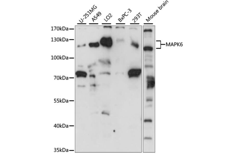 Western Blot - Anti-MAPK6/ERK3 Antibody (A92805) - Antibodies.com