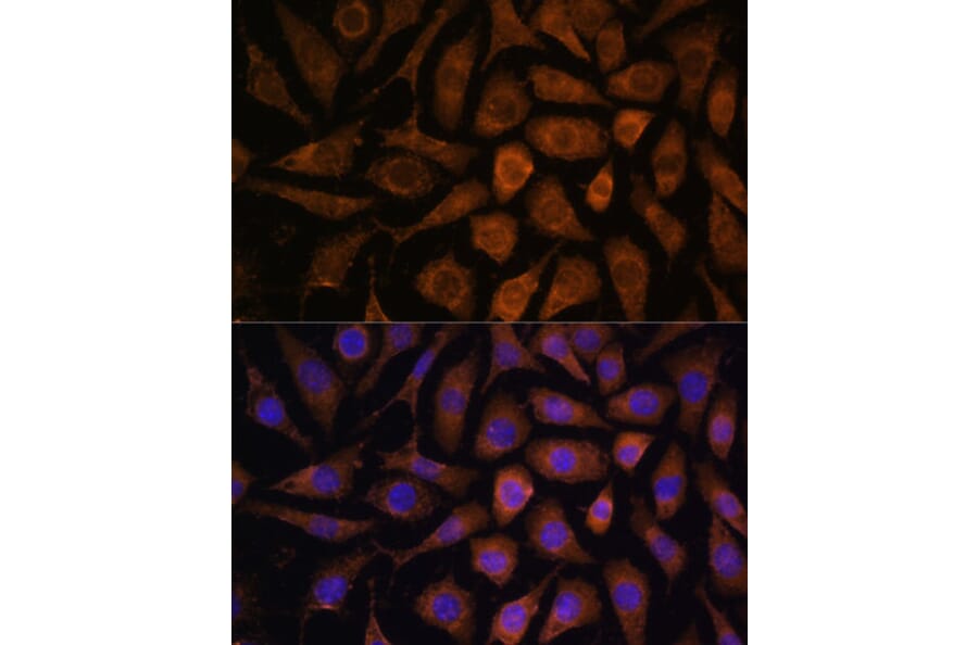 Immunofluorescence - Anti-MAPK6/ERK3 Antibody (A92805) - Antibodies.com