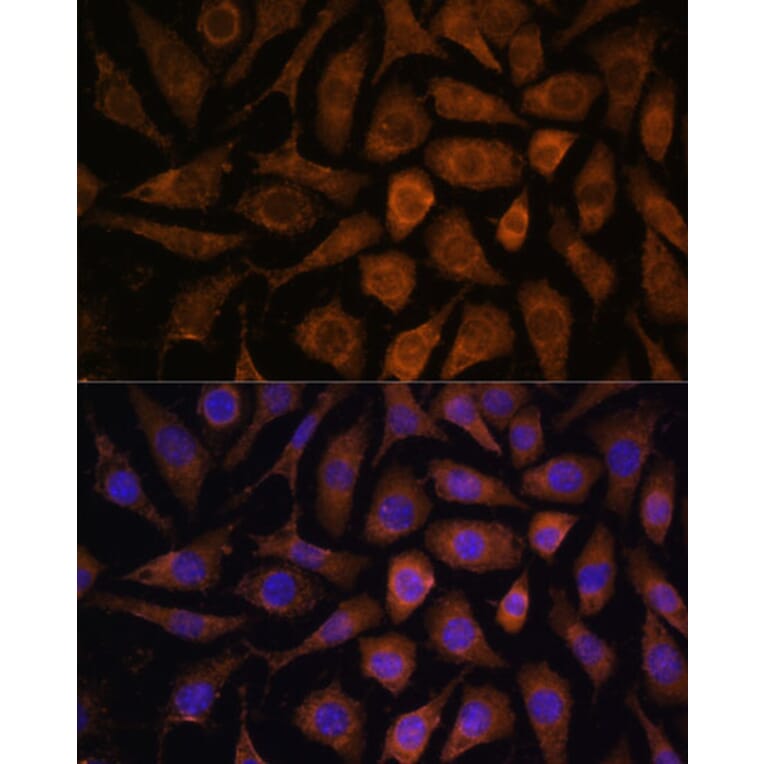 Immunofluorescence - Anti-MAPK6/ERK3 Antibody (A92805) - Antibodies.com