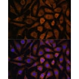 Immunofluorescence - Anti-MAPK6/ERK3 Antibody (A92805) - Antibodies.com