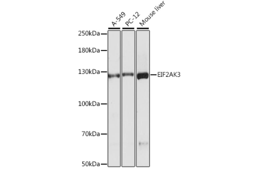 Western Blot - Anti-EIF2AK3 Antibody (A16314) - Antibodies.com