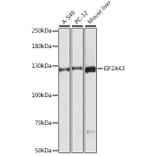 Western Blot - Anti-EIF2AK3 Antibody (A16314) - Antibodies.com