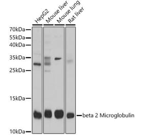 Western Blot - Anti-beta 2 Microglobulin Antibody (A92810) - Antibodies.com