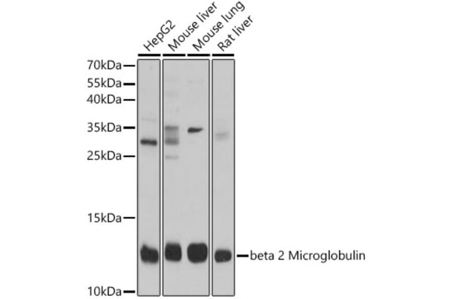 Western Blot - Anti-beta 2 Microglobulin Antibody (A92810) - Antibodies.com