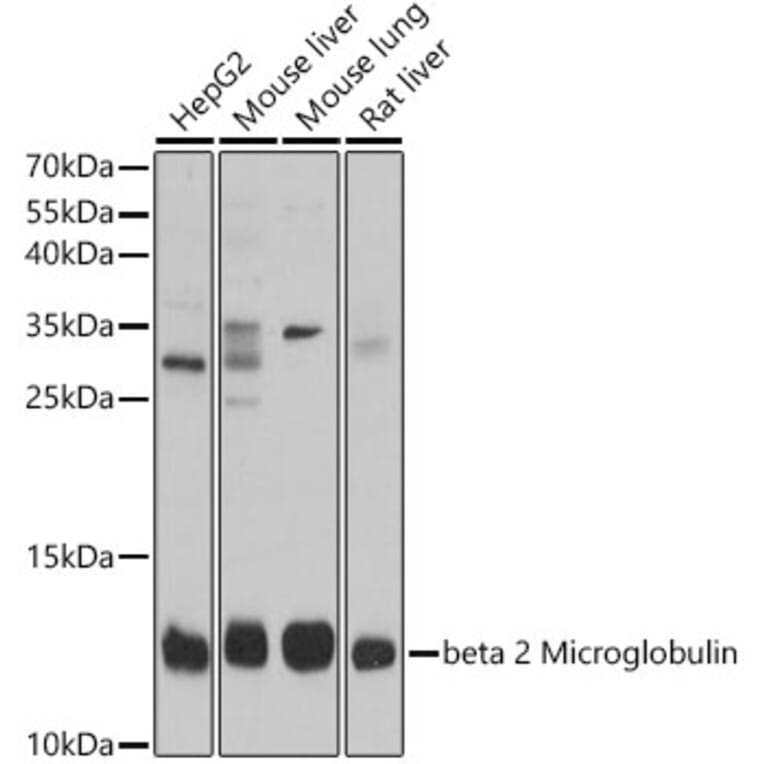 Western Blot - Anti-beta 2 Microglobulin Antibody (A92810) - Antibodies.com