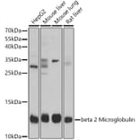 Western Blot - Anti-beta 2 Microglobulin Antibody (A92810) - Antibodies.com