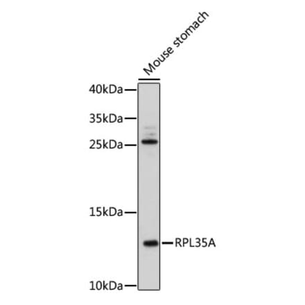 Western Blot - Anti-RPL35A Antibody (A92811) - Antibodies.com