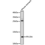 Western Blot - Anti-RPL35A Antibody (A92811) - Antibodies.com