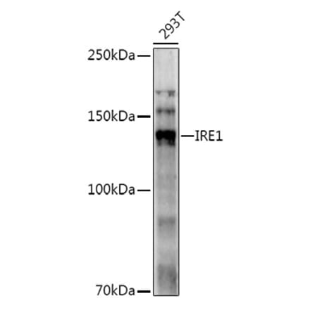 Western Blot - Anti-IRE1 Antibody (A92812) - Antibodies.com